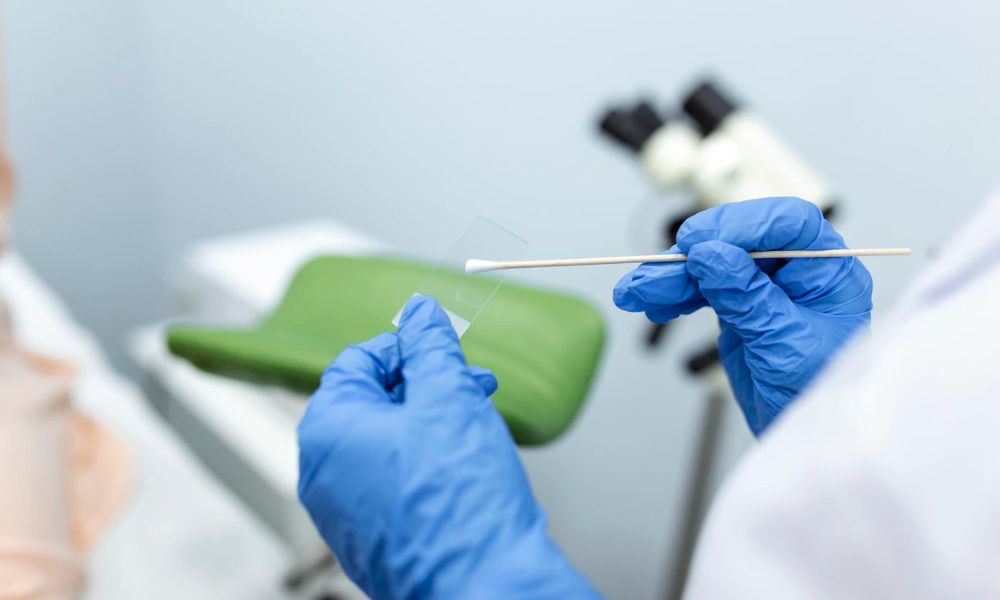  Genital Sistem Enfeksiyonlarında Tek Test İle Etken Belirlenebiliyor